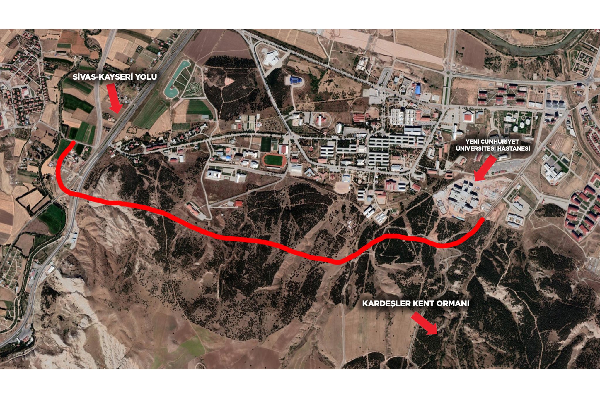 Sivas Ünüversite Hastanesi ne Yeni Yol Düzergahı-sivas gazete haber-radyo bora